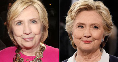 HRC facelift