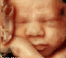Ultrasound 3D Ultrasound 3D